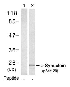 a Synuclein (phospho Ser129) Antibody