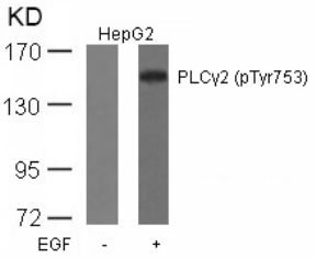 PLCgamma2 (phospho Tyr753) Antibody
