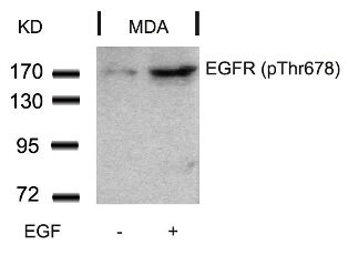 EGFR (phospho Thr678) Antibody