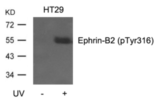 Ephrin B2 (phospho Tyr316) Antibody