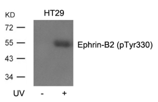 Ephrin B2 (phospho Tyr330) Antibody