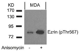Ezrin (phospho Thr567) Antibody