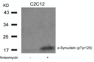 a Synuclein (phospho Tyr125) Antibody