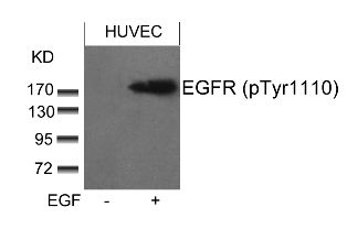 EGFR (phospho Tyr1110) Antibody