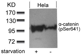 a catenin (phospho Ser641) Antibody
