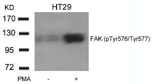 FAK (phospho Tyr576 / Tyr577) Antibody