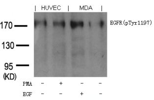 EGFR (phospho Tyr1197) Goat Polyclonal Antibody