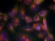 Tau (Ab 356) Antibody