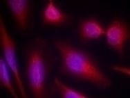 Tau (Ab 214) Antibody