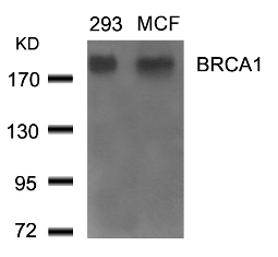 BRCA1 (Ab 1524) Antibody