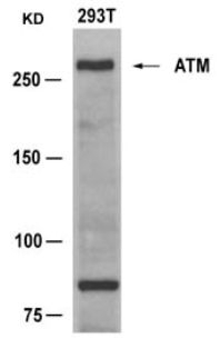 ATM (Ab 1981) Antibody