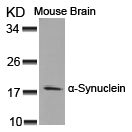 a Synuclein (Ab 125) Antibody