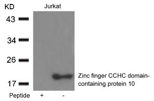 Zinc finger CCHC domain containing protein 10 Antibody