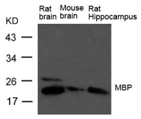 MBP (myelin basic protein) Antibody - Cat. No. 79-741 | ProSci