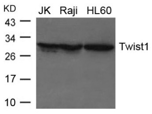 Twist1 Antibody