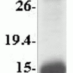 SDS-PAGE analysis of recombinant MyD88 fragment on Coomassie Blue-stained 4-20% gradient gel.