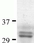 SDS-PAGE analysis of recombinant sCD4 fragment on Coomassie Blue-stained 4-20% gradient gel.