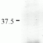 SDS-PAGE analysis of recombinant IL-33 fragment on Coomassie Blue-stained 4-20% gradient gel.