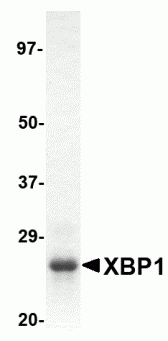 XBP1 Recombinant Protein
