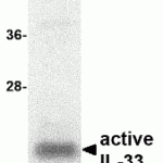 SDS-PAGE analysis of recombinant IL-33 fragment on Coomassie Blue-stained 12% gradient gel.