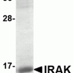 SDS-PAGE analysis of recombinant IRAK fragment on Coomassie Blue-stained 12% SDS-PAGE gel.