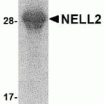 SDS-PAGE analysis of recombinant NELL2 fragment on Coomassie Blue-stained 12% SDS-PAGE gel.
