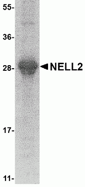 NELL2 Recombinant Protein