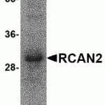 SDS-PAGE analysis of recombinant RCAN2 on Coomassie Blue-stained 12% SDS-PAGE gel.