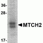 SDS-PAGE analysis of recombinant MTCH2 on Coomassie Blue-stained 12% SDS-PAGE gel.