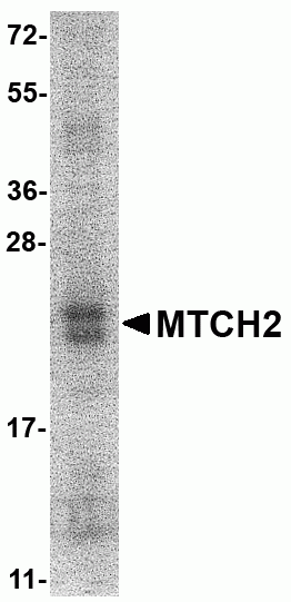 MTCH2 Recombinant Protein