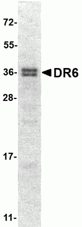 DR6 Cytoplasmic Domain Recombinant Protein