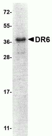 DR6 Extracellular Domain Recombinant Protein