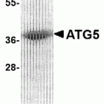SDS-PAGE analysis of recombinant ATG5 on Coomassie Blue-stained 4 - 12% SDS-PAGE gel.
