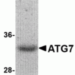 SDS-PAGE analysis of recombinant ATG7 on Coomassie Blue-stained 4 - 12% SDS-PAGE gel.