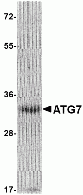 ATG7 Recombinant Protein