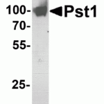 SDS PAGE analysis of Pst1 protein. Purified Pst1 protein (0.5 μg) was separated by 10% SDS PAGE gel, and stained with silver.