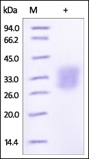 ANGPTL3 Recombinant Protein