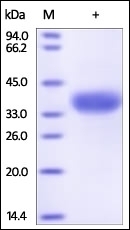ANGPTL4 (166-406) Recombinant Protein