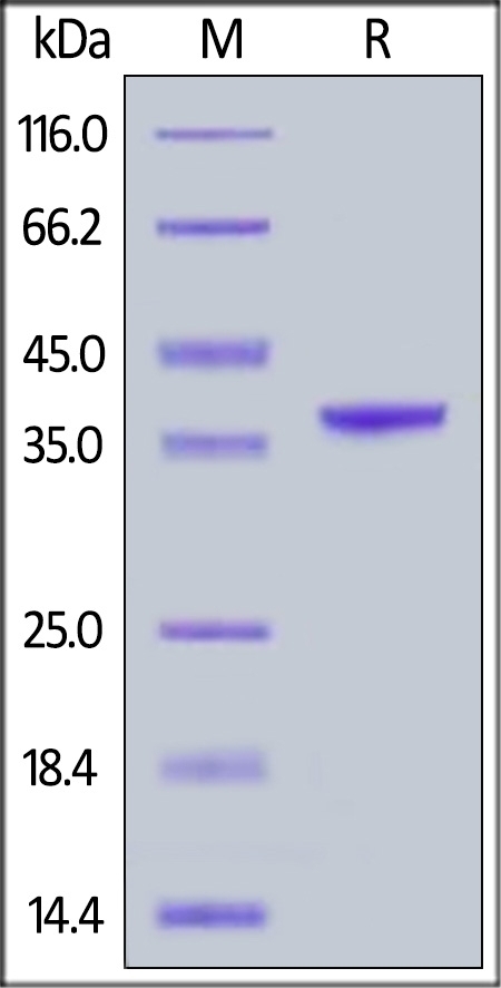 Arginase 1 Recombinant Protein