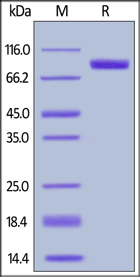 HER2 Recombinant Protein