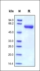 MMP9 Recombinant Protein