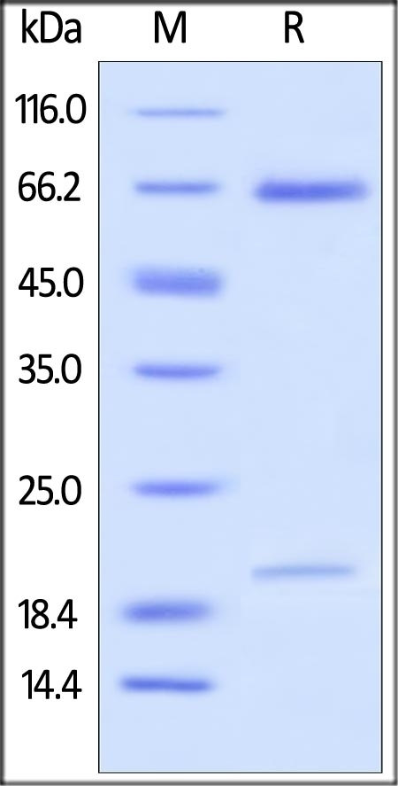 PCSK9 Recombinant Protein