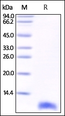 S100B Recombinant Protein