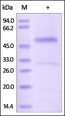 Serpin H1 Recombinant Protein
