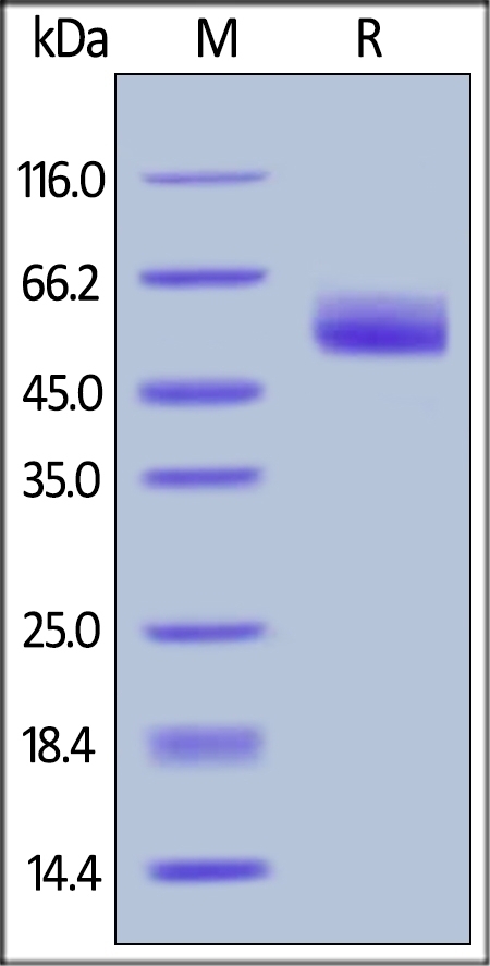 SERPINA3 Recombinant Protein