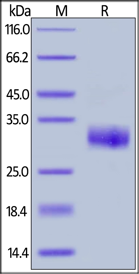 TIMP1 Recombinant Protein
