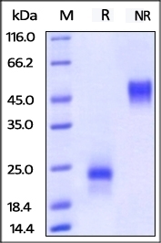 VEGF 165 Recombinant Protein