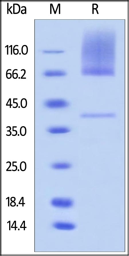 Glypican 3 Recombinant Protein