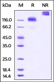 M-CSF R Recombinant Protein