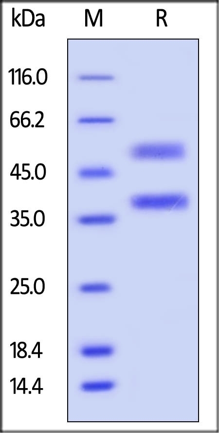 ANGPTL7 Recombinant Protein
